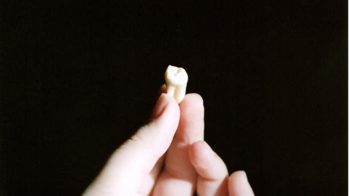 Hand holding a wisdom tooth